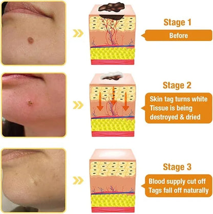 The Ordinary Niacinamide 10% + Zinc 1% Serum for All Skin