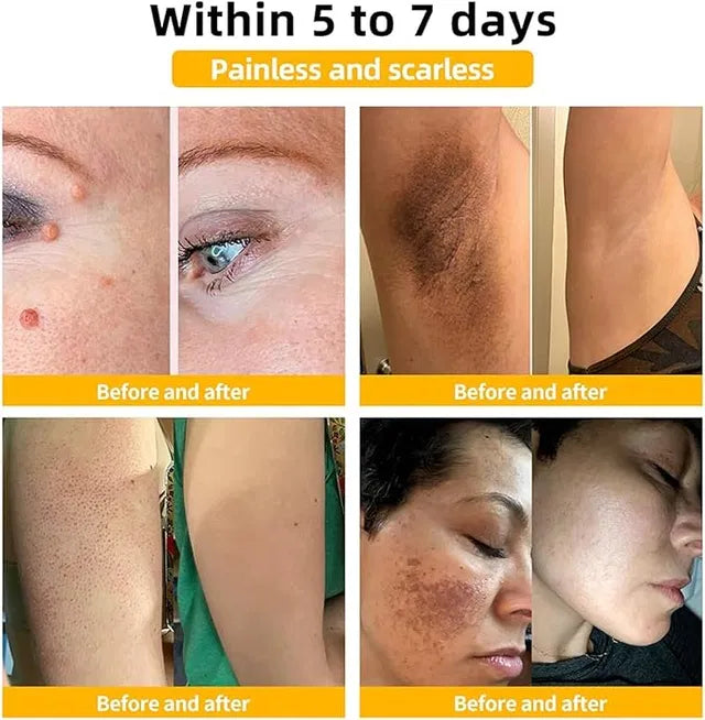 The Ordinary Niacinamide 10% + Zinc 1% Serum for All Skin