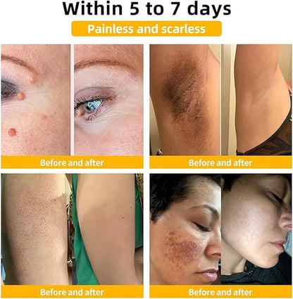 The Ordinary Niacinamide 10% + Zinc 1% Serum for All Skin